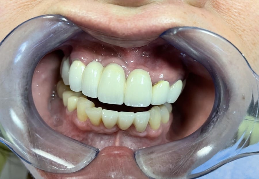 before image of dental procedure
